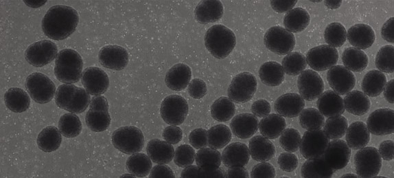 human-neurospheres-brain-spheroids-wp143-cropped