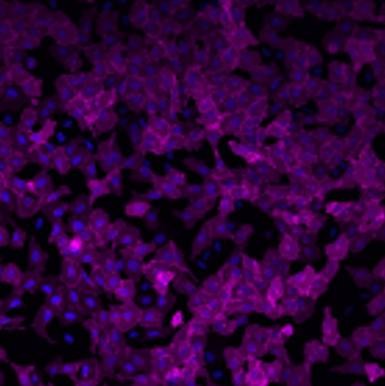 Cell image of U2OS cells stably expressing HaloTag® protein fused to three copies of a nuclear localization sequence (labeled with Janelia Fluor® 635i HaloTag® Ligand).