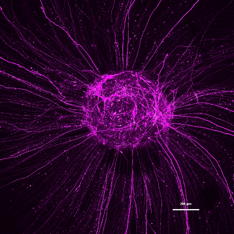 view-snapshot-only-magenta-with-scale-bar