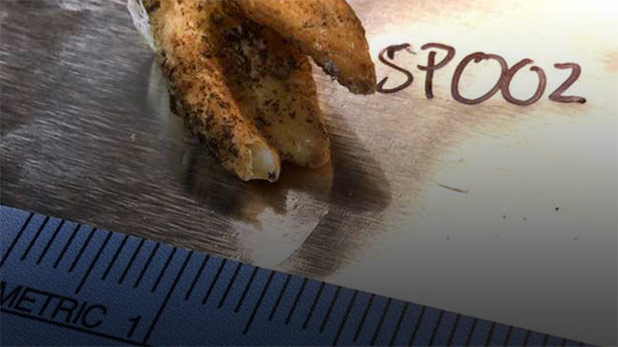 29814220-MediumImage_Tooth